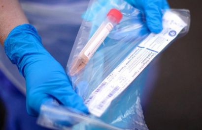 За последние сутки в Челябинской области 5 новых подтвержденных случаев коронавирусной инфекции