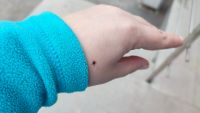 За неделю 13 устькатавцев пострадали от клещей